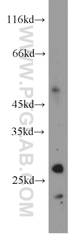 PEX11A