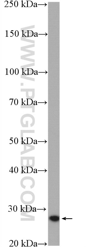 WB analysis of mouse testis using 15744-1-AP