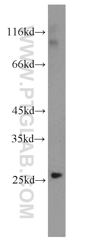 Western Blot (WB) analysis of human testis tissue using PEX11G Polyclonal antibody (15744-1-AP)