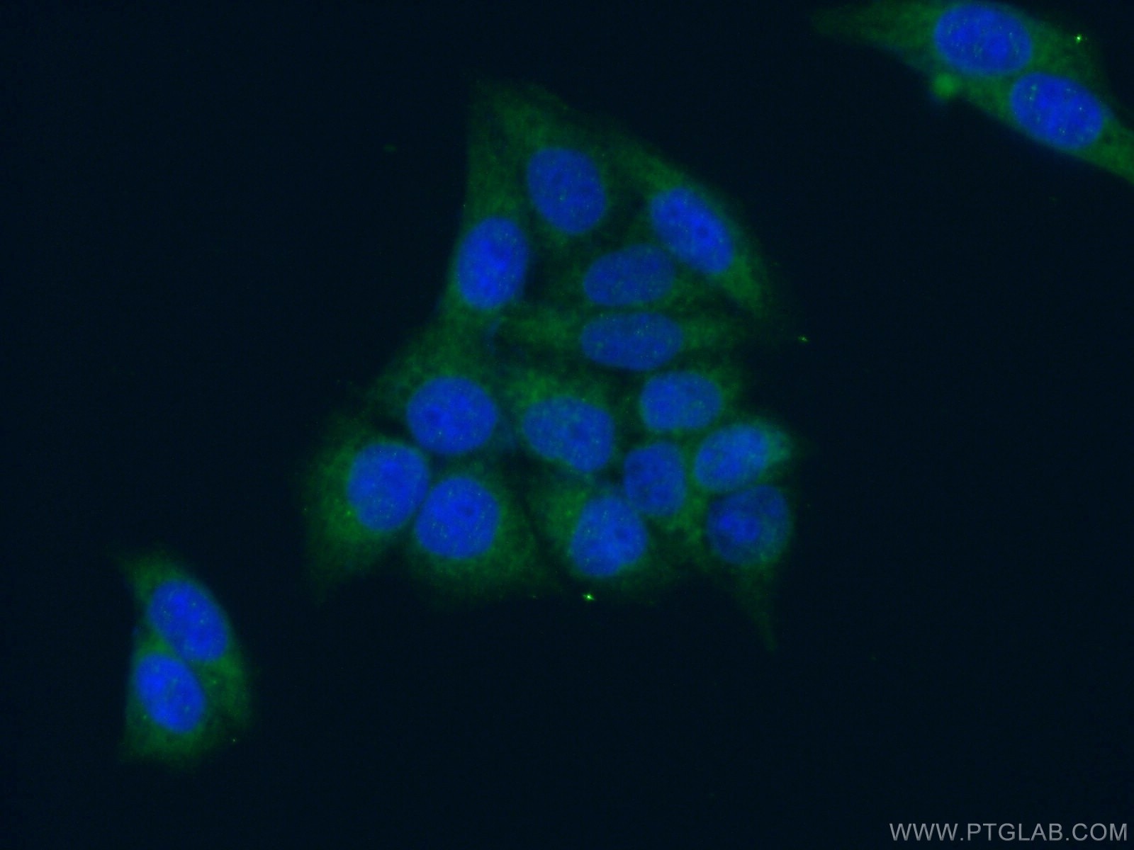 Immunofluorescence (IF) / fluorescent staining of HeLa cells using PEX13 Polyclonal antibody (26649-1-AP)