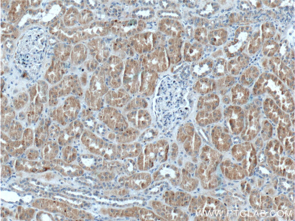 Immunohistochemistry (IHC) staining of human kidney tissue using PEX13 Polyclonal antibody (26649-1-AP)