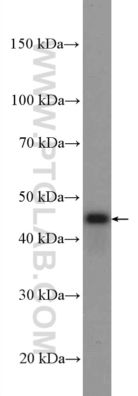 Western Blot (WB) analysis of Jurkat cells using PEX13 Polyclonal antibody (26649-1-AP)