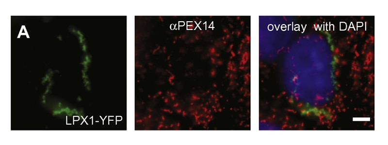 Immunofluorescence (IF) / fluorescent staining of COS7 cells using PEX14 Polyclonal antibody (10594-1-AP)