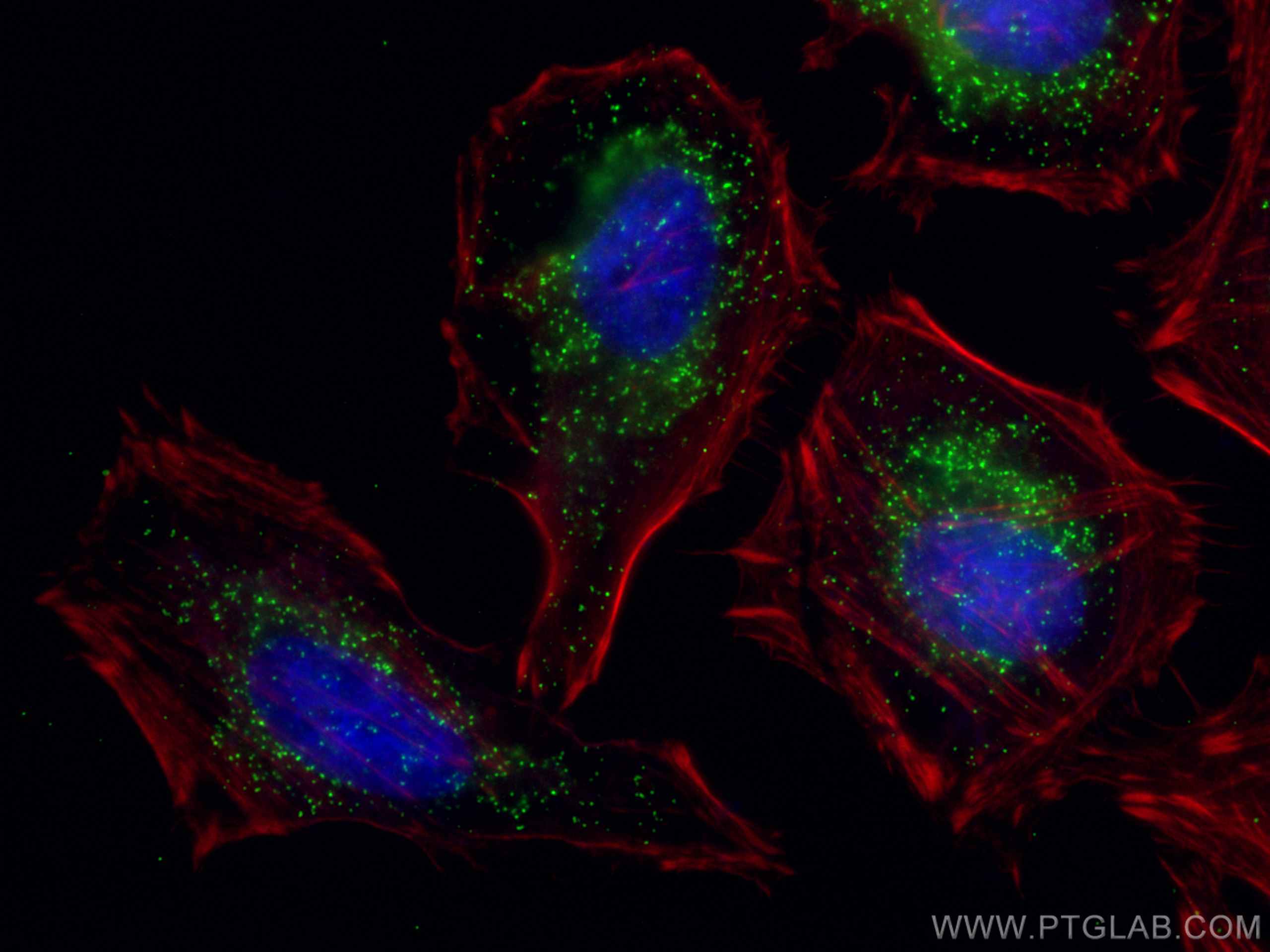 IF Staining of HeLa using 10594-1-AP