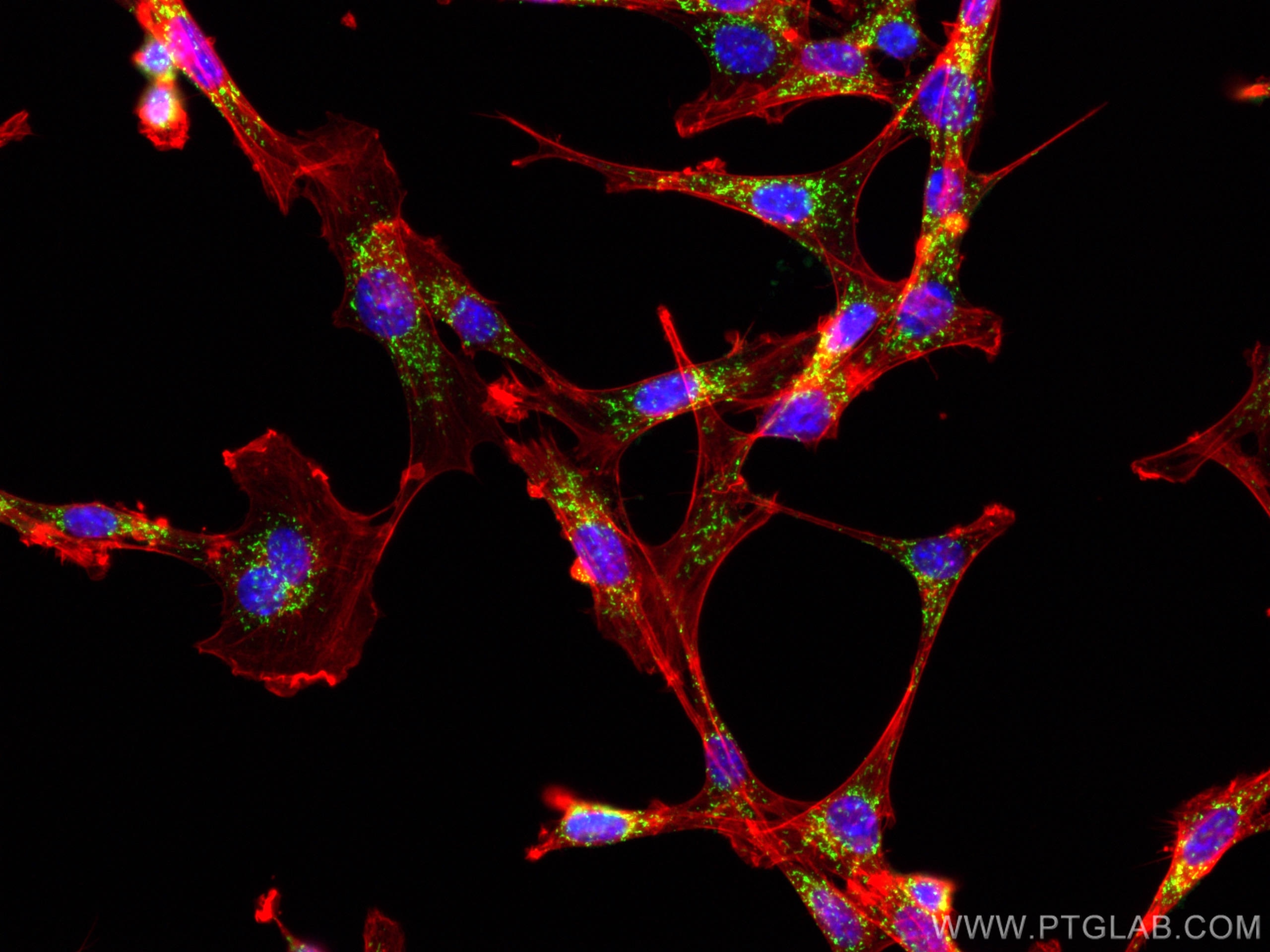 Immunofluorescence (IF) / fluorescent staining of NIH/3T3 cells using PEX14 Polyclonal antibody (10594-1-AP)