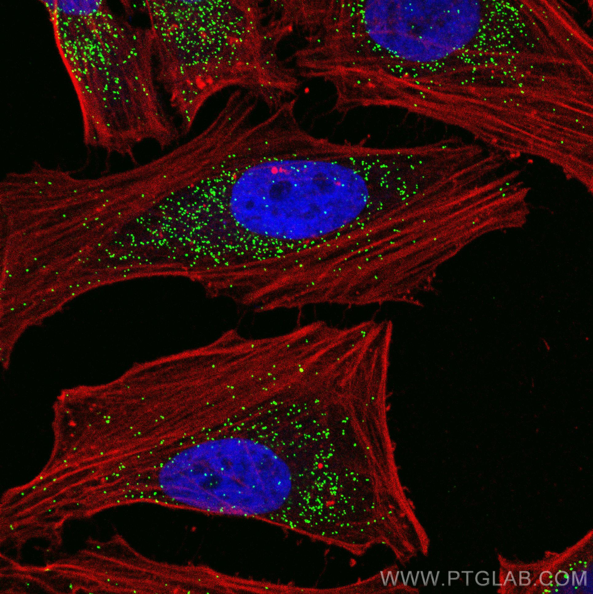 IF Staining of HeLa using 10594-1-AP