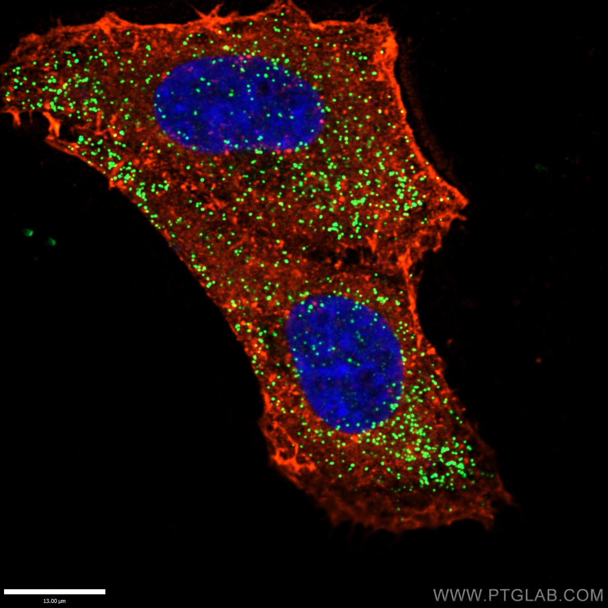 Immunofluorescence (IF) / fluorescent staining of HepG2 cells using PEX14 Polyclonal antibody (10594-1-AP)