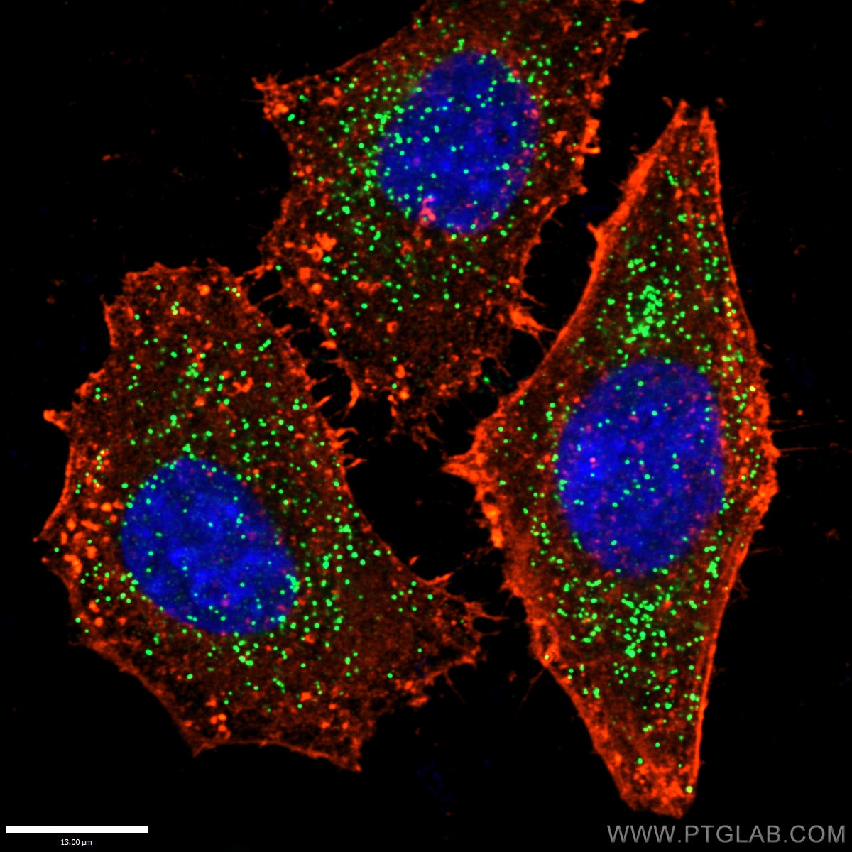 Immunofluorescence (IF) / fluorescent staining of HepG2 cells using PEX14 Polyclonal antibody (10594-1-AP)