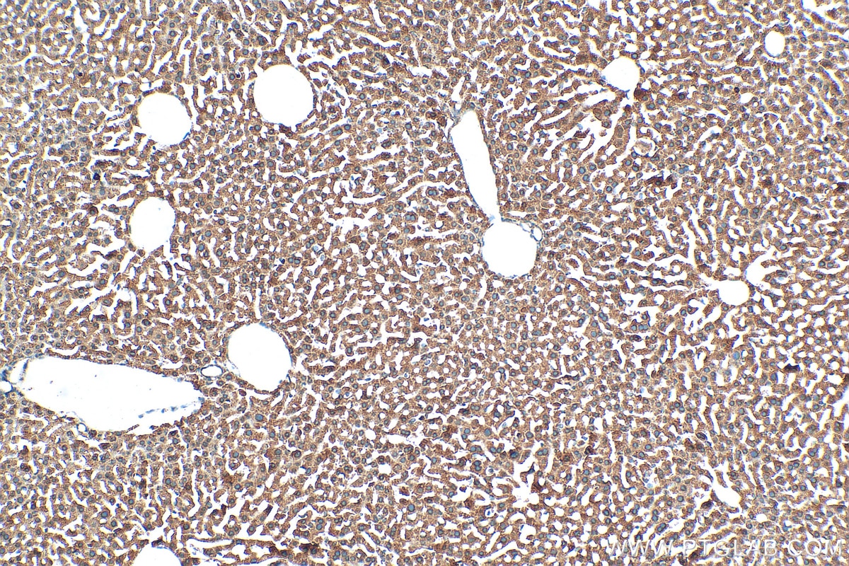 IHC staining of mouse liver using 10594-1-AP