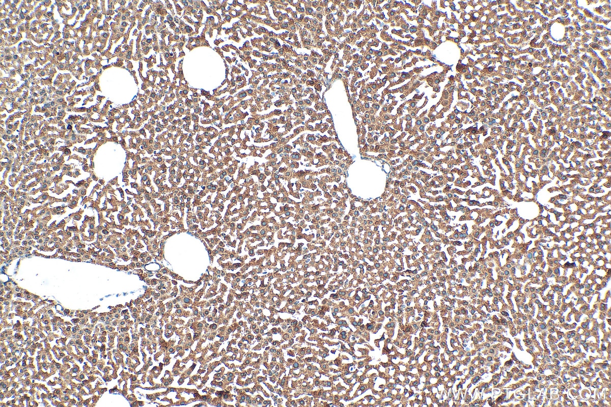 Immunohistochemistry (IHC) staining of mouse liver tissue using PEX14 Polyclonal antibody (10594-1-AP)