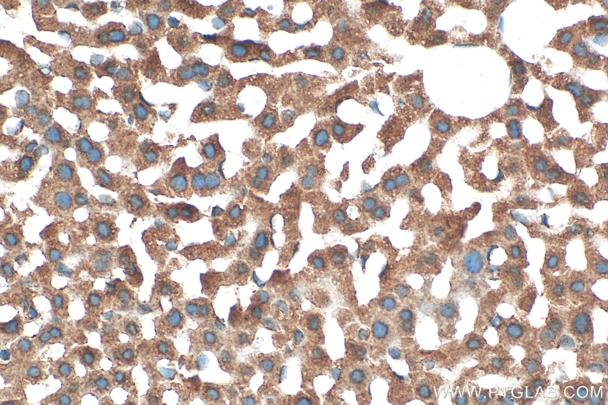 Immunohistochemistry (IHC) staining of mouse liver tissue using PEX14 Polyclonal antibody (10594-1-AP)