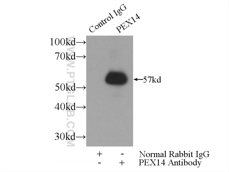 Immunoprecipitation (IP) experiment of mouse liver tissue using PEX14 Polyclonal antibody (10594-1-AP)