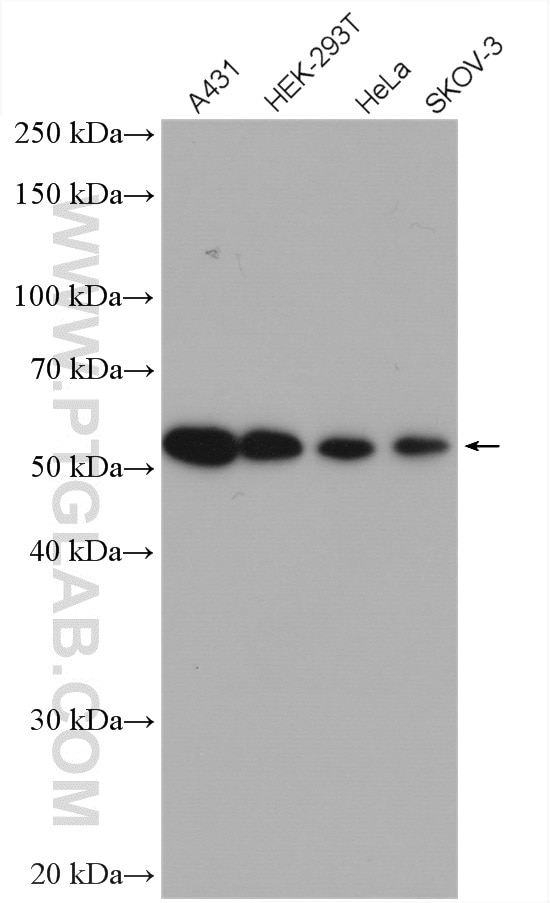 Western Blot (WB) analysis of various lysates using PEX14 Polyclonal antibody (10594-1-AP)