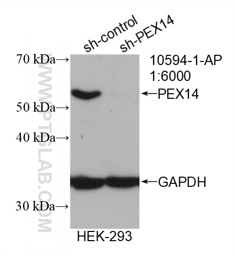 Western Blot (WB) analysis of HEK-293 cells using PEX14 Polyclonal antibody (10594-1-AP)