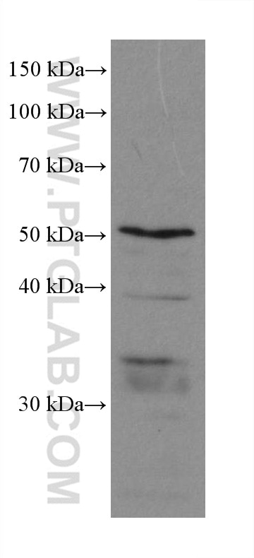 Western Blot (WB) analysis of LNCaP cells using PEX14 Recombinant antibody (80234-1-RR)