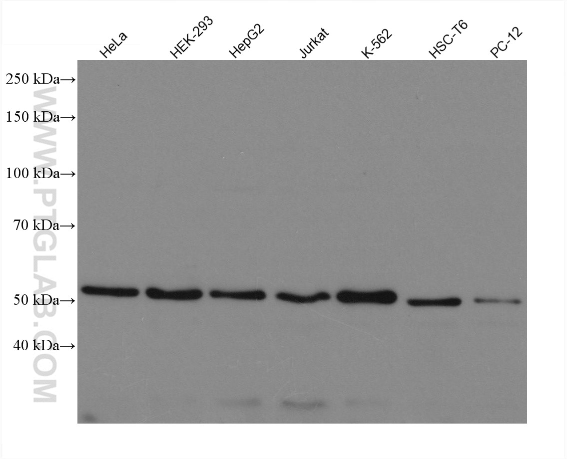 Western Blot (WB) analysis of various lysates using PEX14 Recombinant antibody (80234-1-RR)
