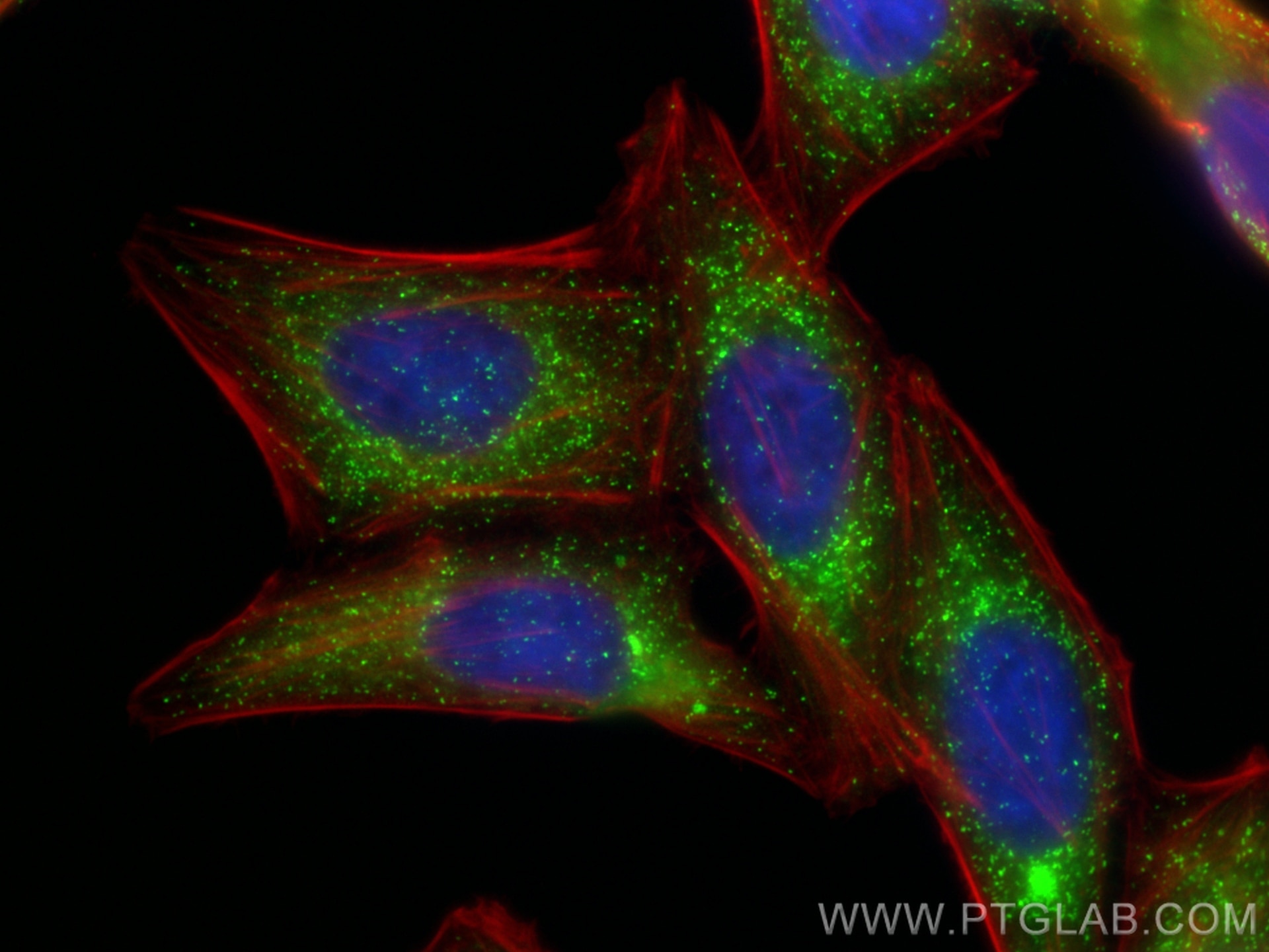 Immunofluorescence (IF) / fluorescent staining of HepG2 cells using Biotin-conjugated PEX14 Polyclonal antibody (Biotin-10594)