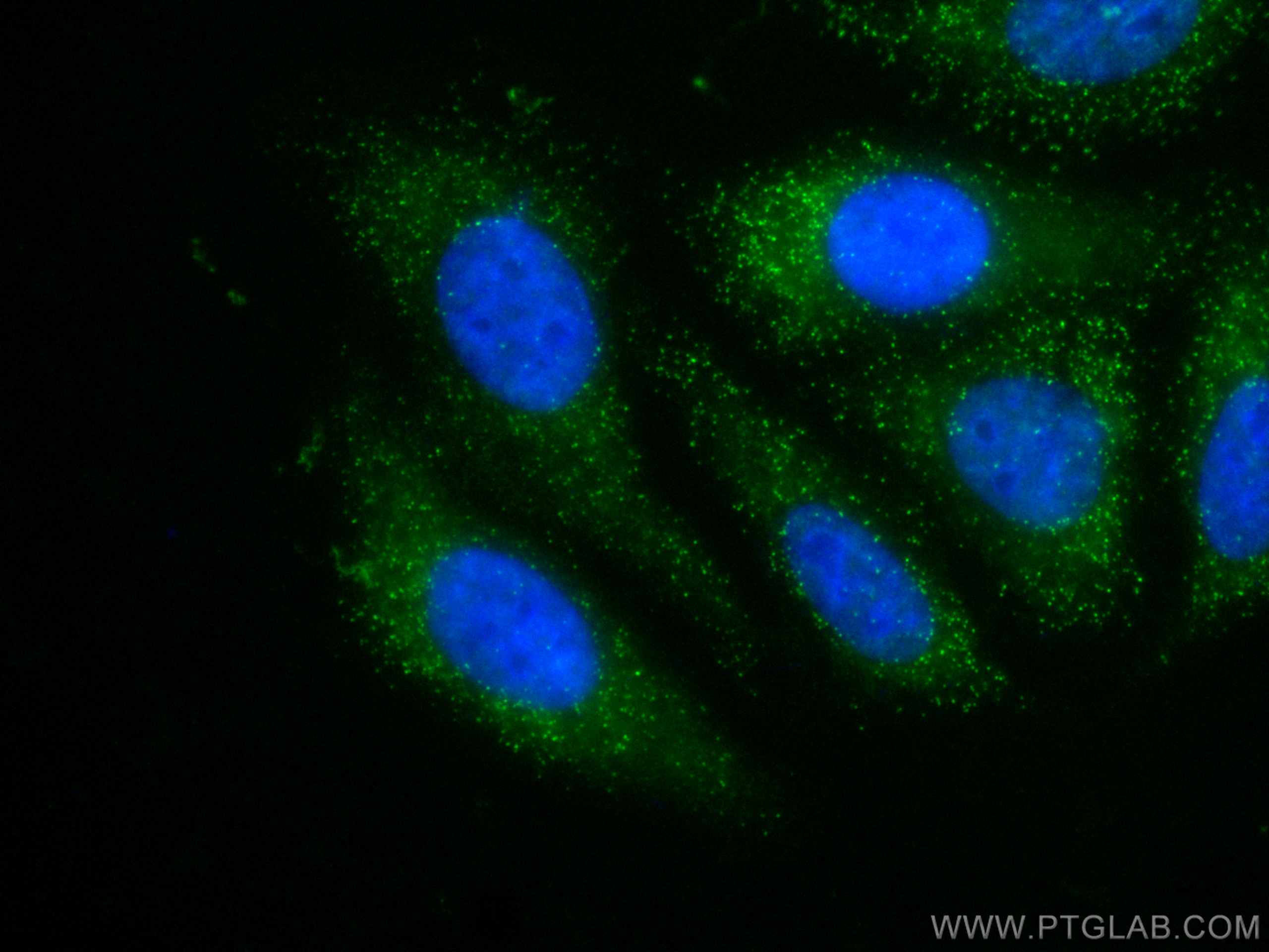 Immunofluorescence (IF) / fluorescent staining of HepG2 cells using CoraLite® Plus 488-conjugated PEX14 Polyclonal ant (CL488-10594)