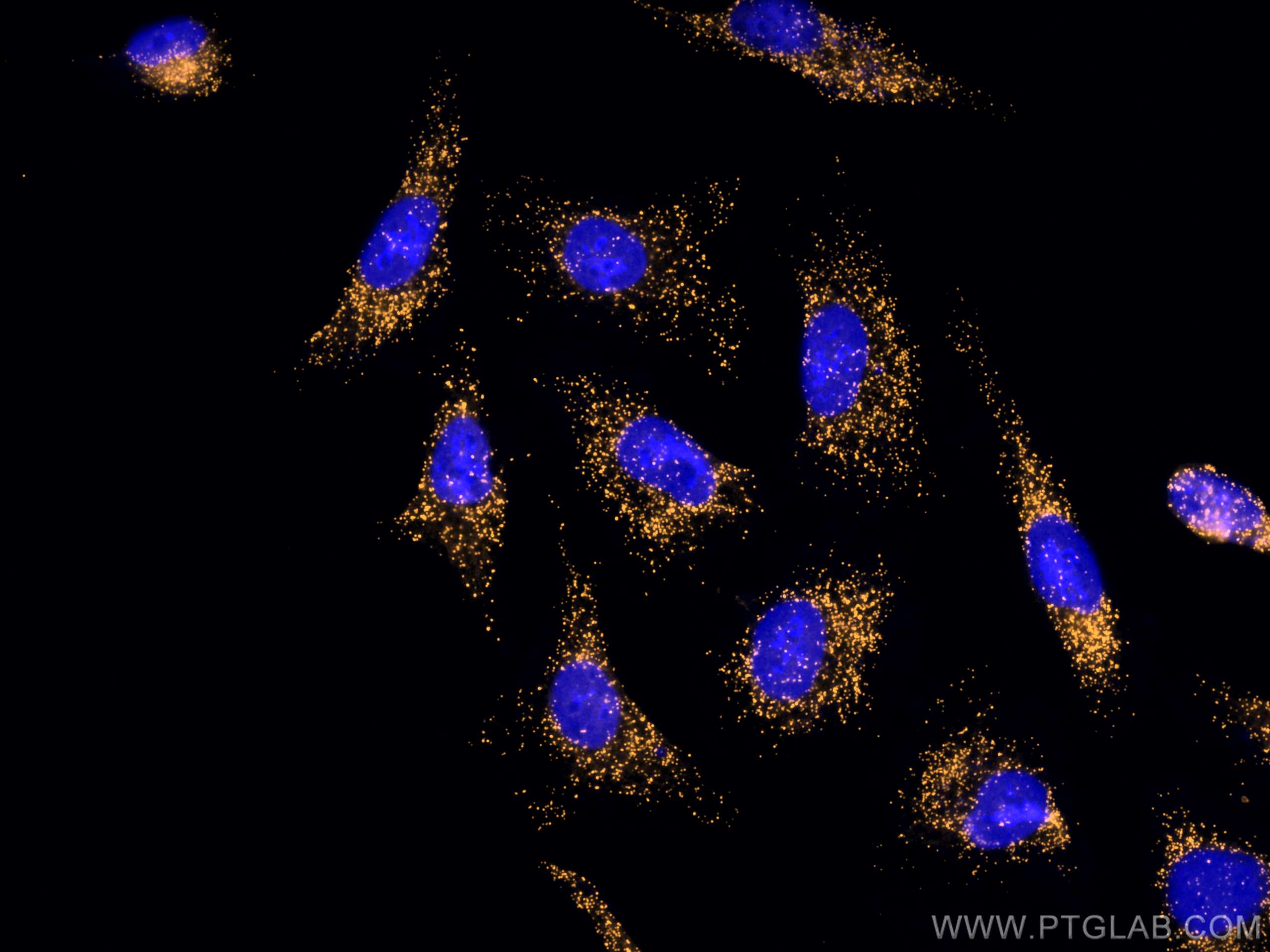 Immunofluorescence (IF) / fluorescent staining of HeLa cells using CoraLite®555-conjugated PEX14 Polyclonal antibody (CL555-10594)