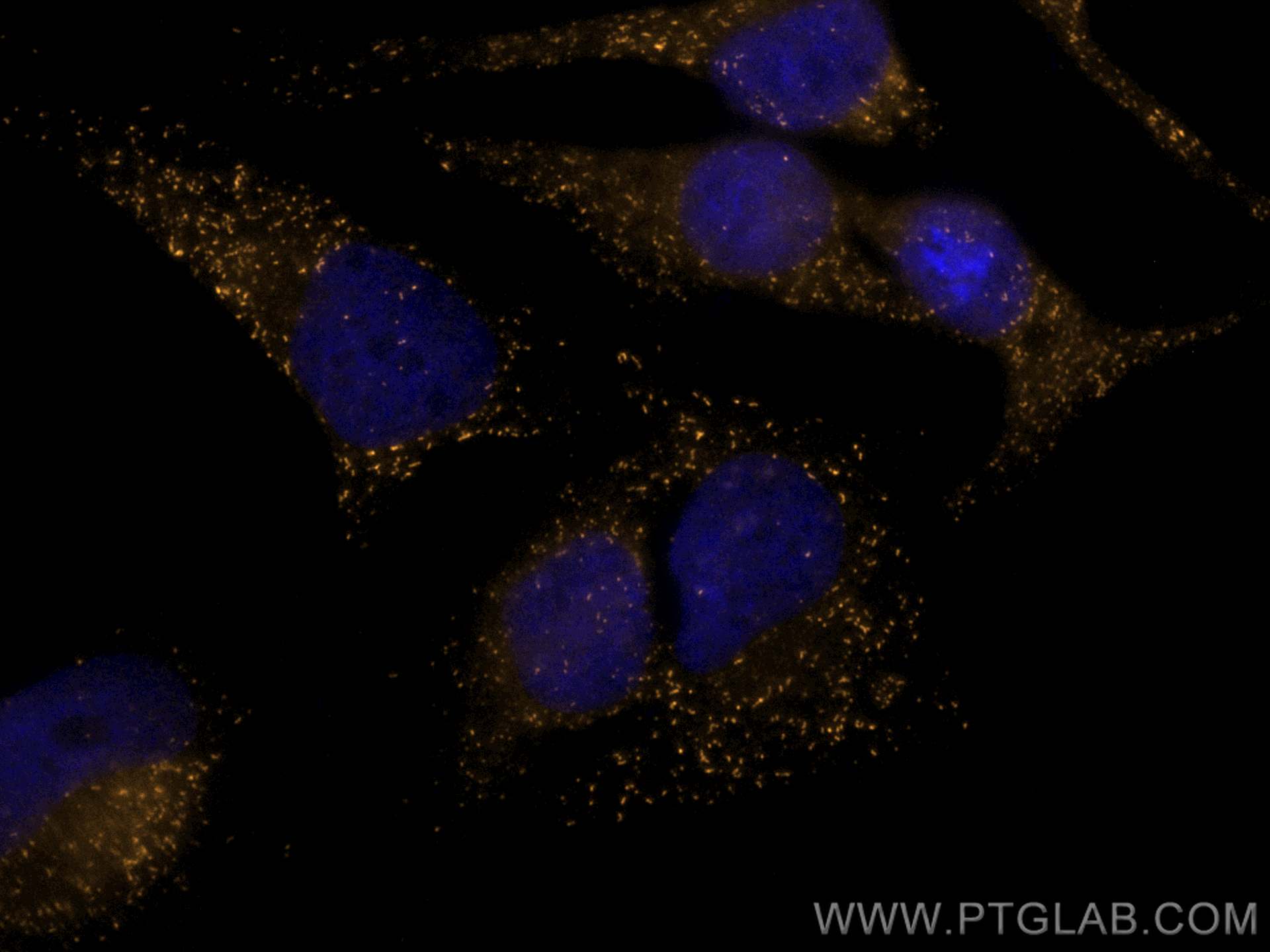 Immunofluorescence (IF) / fluorescent staining of HeLa cells using CoraLite®555-conjugated PEX14 Recombinant antibody (CL555-80234)