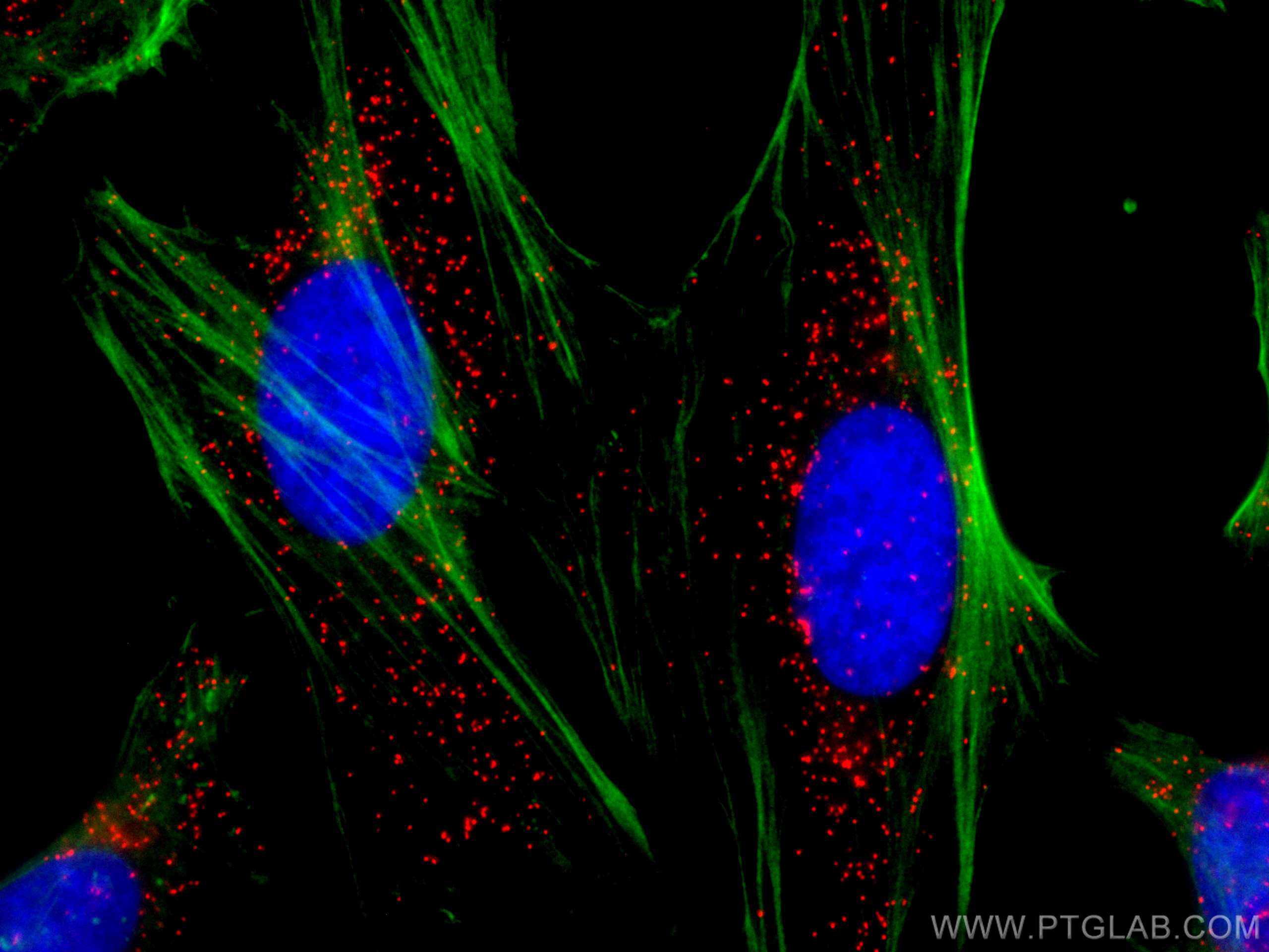 Immunofluorescence (IF) / fluorescent staining of HeLa cells using CoraLite®594-conjugated PEX14 Polyclonal antibody (CL594-10594)