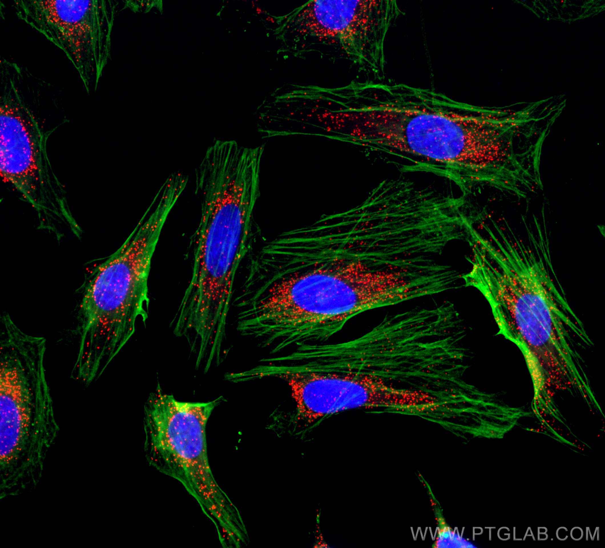 Immunofluorescence (IF) / fluorescent staining of HeLa cells using CoraLite®594-conjugated PEX14 Polyclonal antibody (CL594-10594)