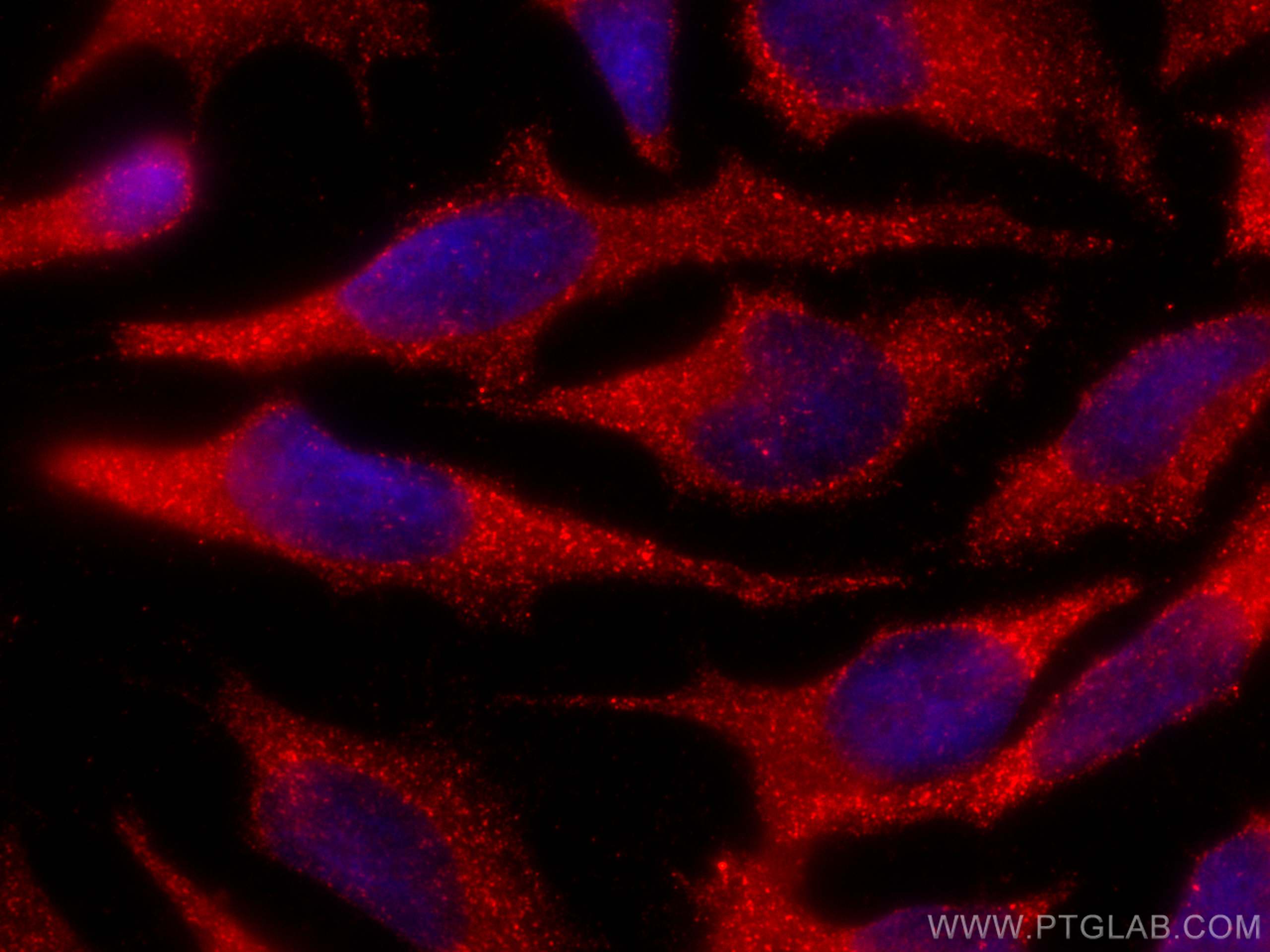 Immunofluorescence (IF) / fluorescent staining of HeLa cells using CoraLite®594-conjugated PEX14 Recombinant antibody (CL594-80234)