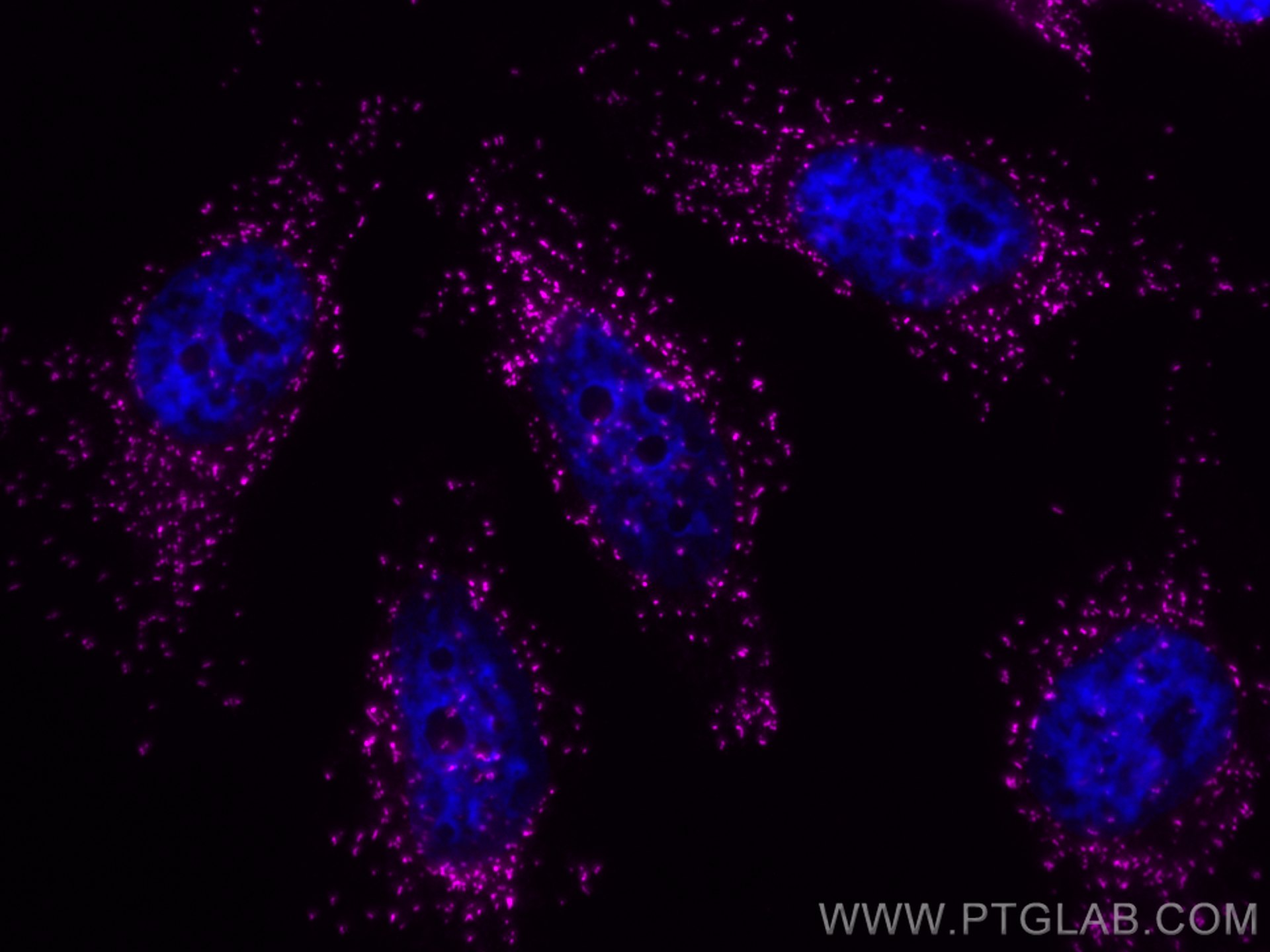 Immunofluorescence (IF) / fluorescent staining of HeLa cells using CoraLite® Plus 647-conjugated PEX14 Polyclonal ant (CL647-10594)