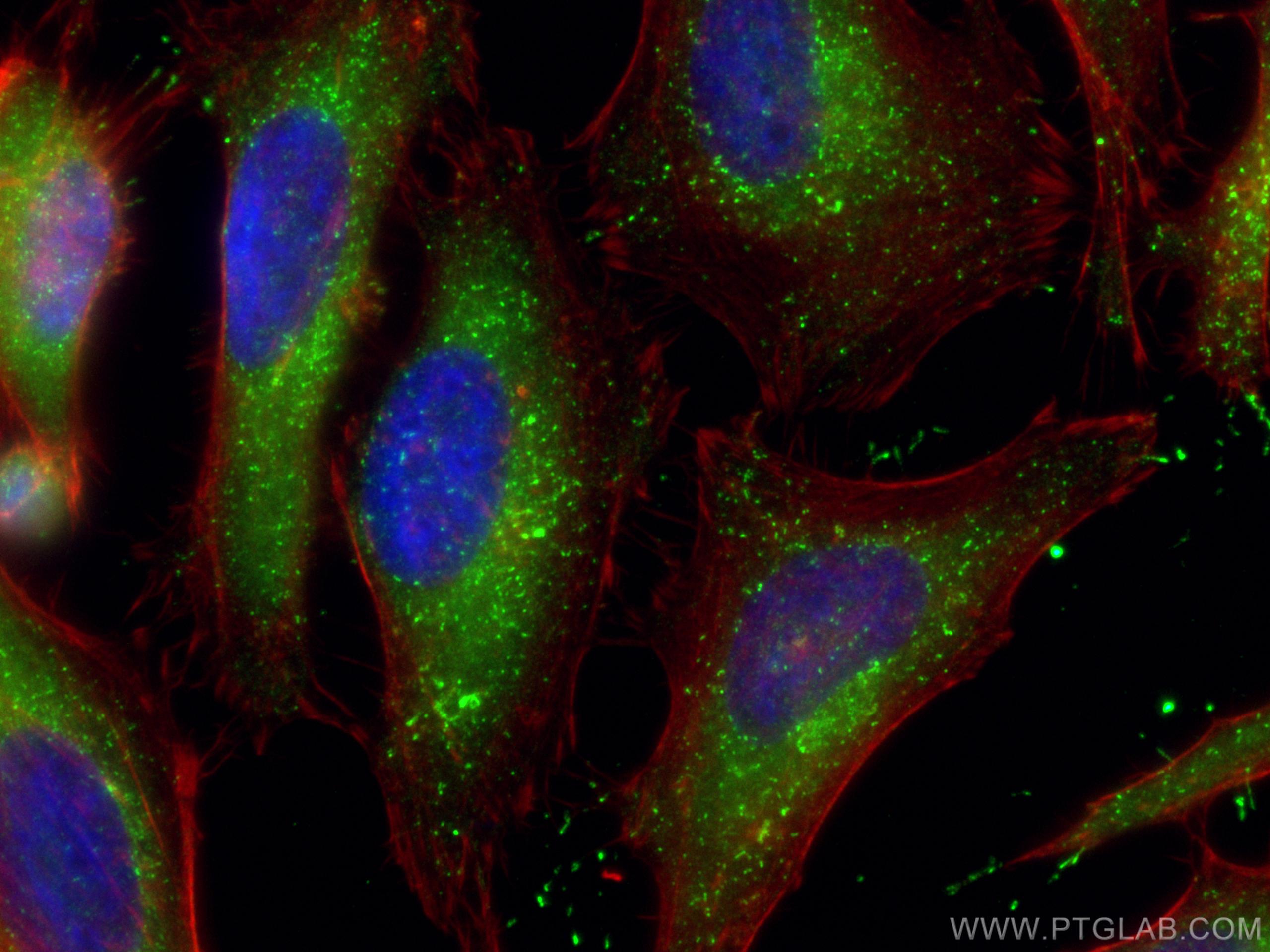 Immunofluorescence (IF) / fluorescent staining of HeLa cells using PEX14 (human specific) Recombinant antibody (80196-1-RR)