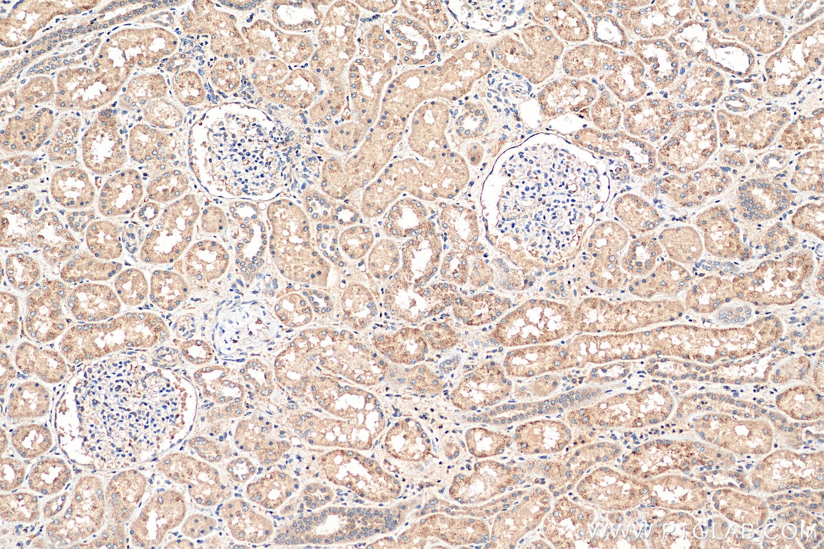 Immunohistochemistry (IHC) staining of human kidney tissue using PEX14 (human specific) Recombinant antibody (80196-1-RR)