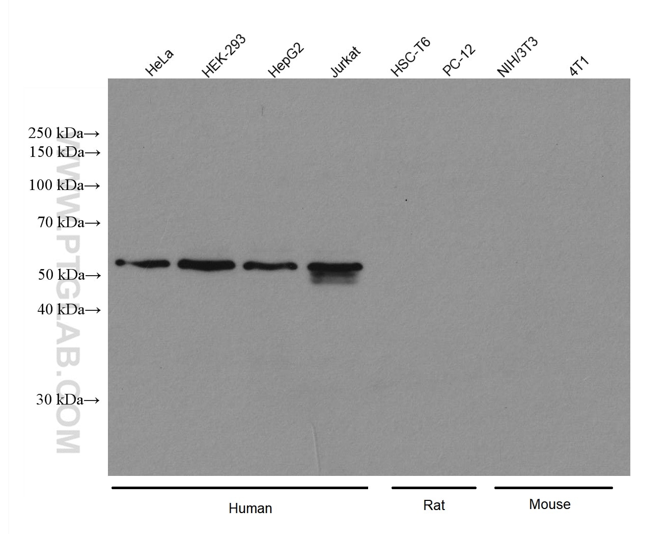 Western Blot (WB) analysis of various lysates using PEX14 (human specific) Recombinant antibody (80196-1-RR)
