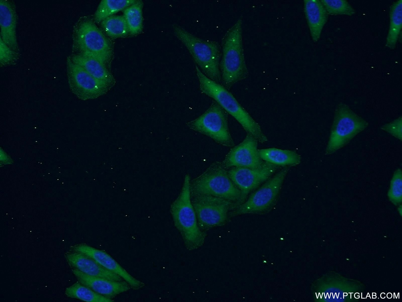 Immunofluorescence (IF) / fluorescent staining of HepG2 cells using PEX16 Polyclonal antibody (14816-1-AP)