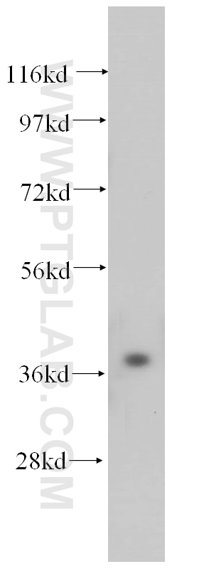 PEX16 Polyclonal antibody