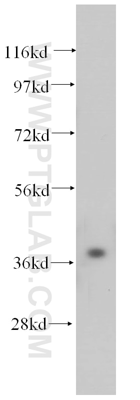 WB analysis of human liver using 14816-1-AP