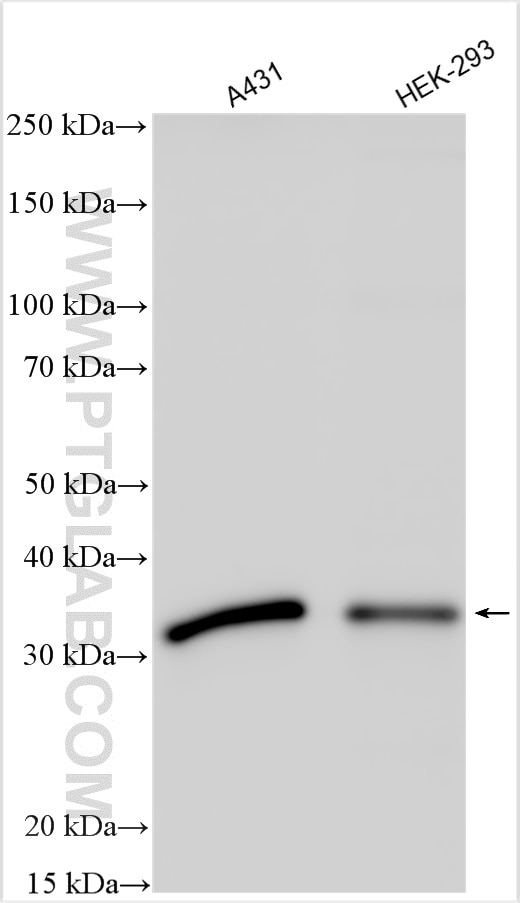 Western Blot (WB) analysis of various lysates using PEX26 Polyclonal antibody (27472-1-AP)