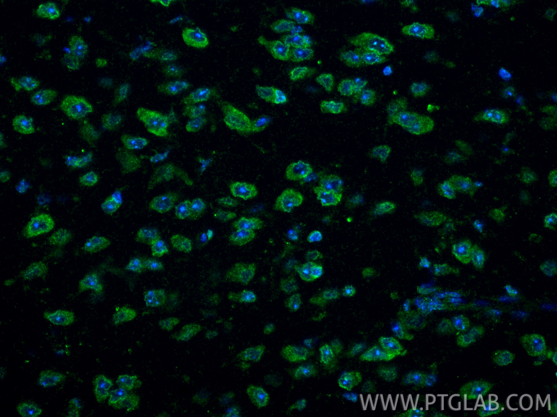 Immunofluorescence (IF) / fluorescent staining of mouse brain tissue using PEX3 Polyclonal antibody (10946-1-AP)