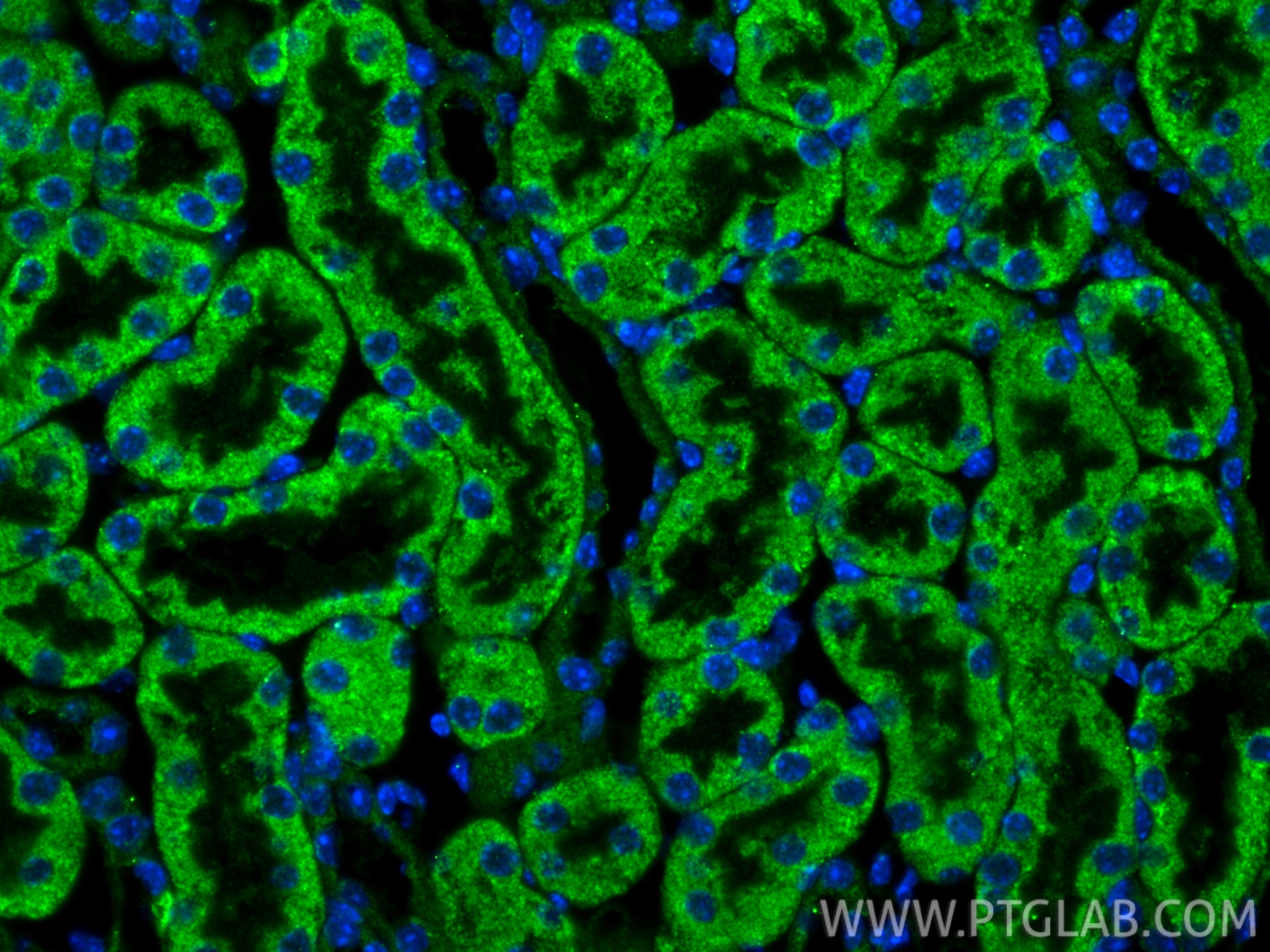 Immunofluorescence (IF) / fluorescent staining of mouse kidney tissue using PEX3 Polyclonal antibody (10946-1-AP)