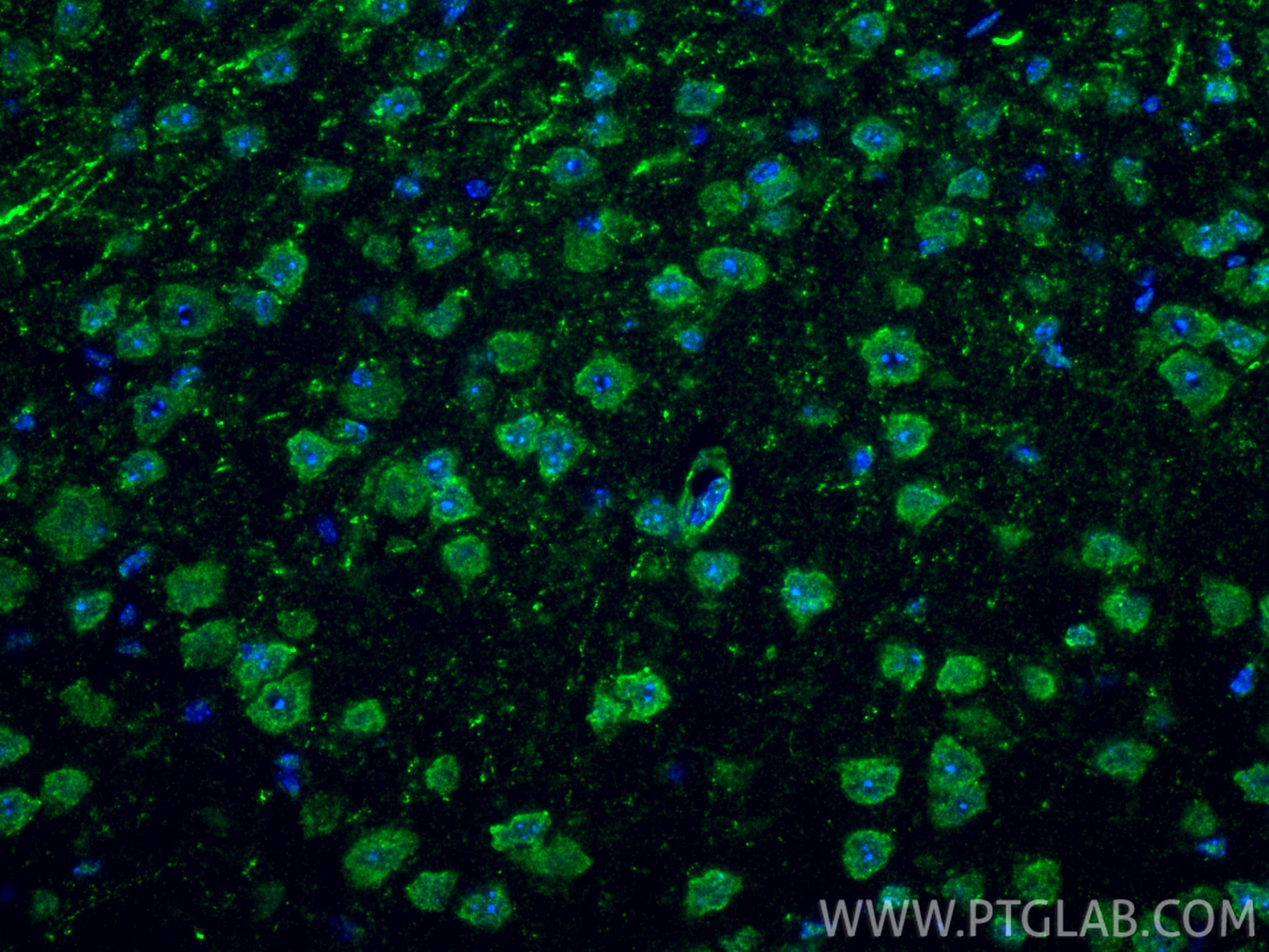 Immunofluorescence (IF) / fluorescent staining of mouse brain tissue using PEX3 Polyclonal antibody (30424-1-AP)