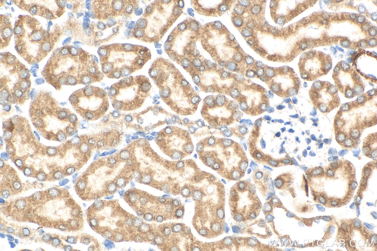 Immunohistochemistry (IHC) staining of mouse kidney tissue using PEX3 Polyclonal antibody (30424-1-AP)