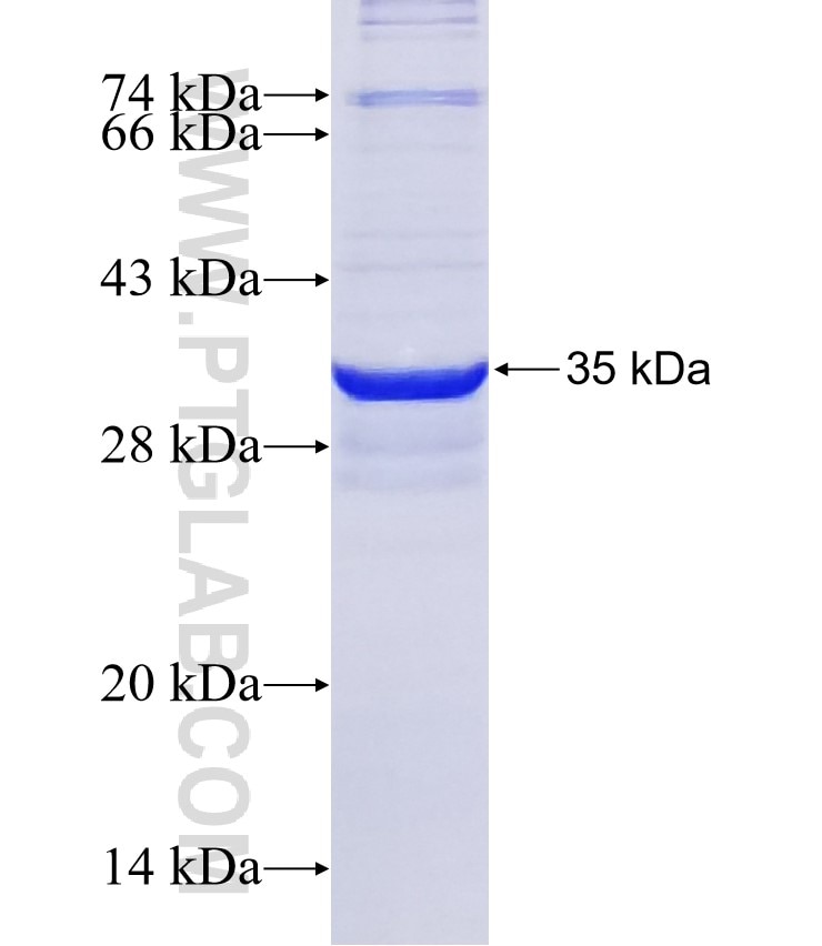 PEX3 fusion protein Ag31516 SDS-PAGE