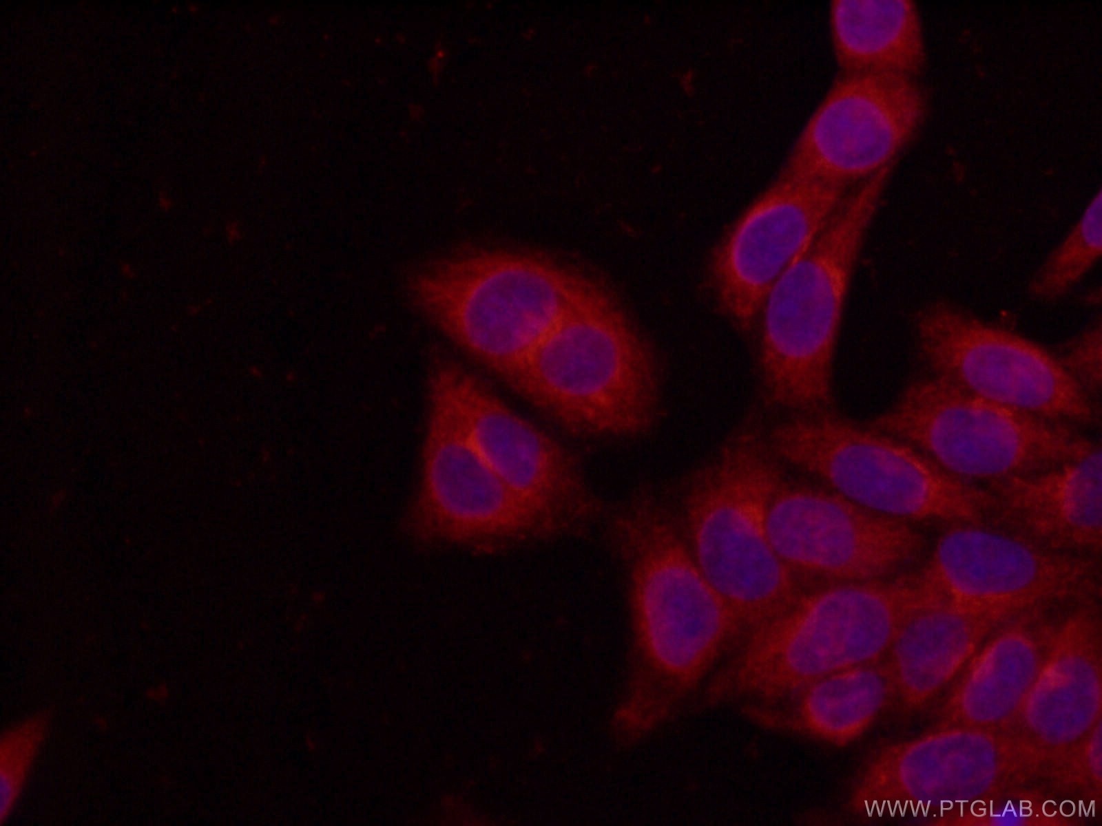 Immunofluorescence (IF) / fluorescent staining of HeLa cells using PEX5 Polyclonal antibody (12545-1-AP)