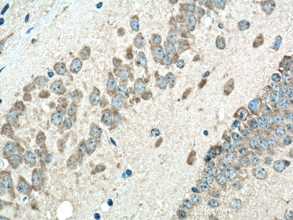 Immunohistochemistry (IHC) staining of mouse brain tissue using PEX5 Polyclonal antibody (12545-1-AP)