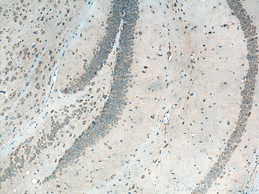 Immunohistochemistry (IHC) staining of mouse brain tissue using PEX5 Polyclonal antibody (12545-1-AP)