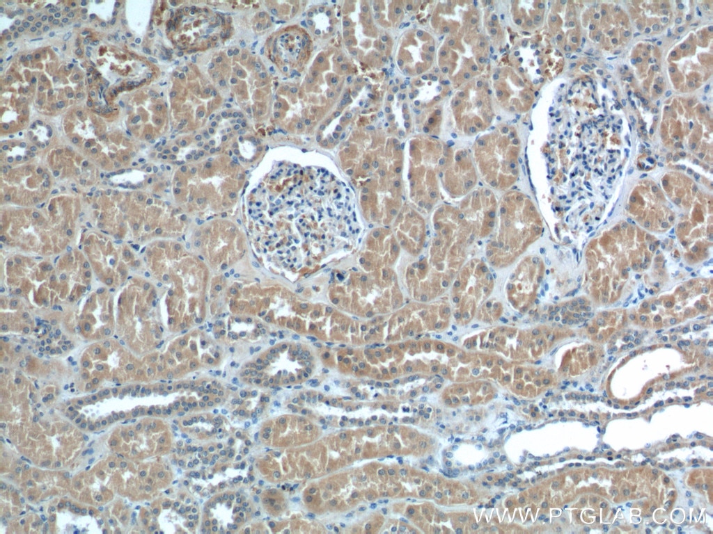 Immunohistochemistry (IHC) staining of human kidney tissue using PEX5 Polyclonal antibody (12545-1-AP)