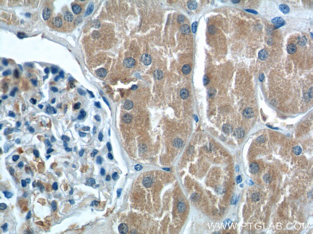 Immunohistochemistry (IHC) staining of human kidney tissue using PEX5 Polyclonal antibody (12545-1-AP)