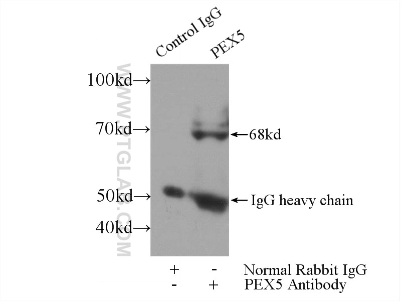 Immunoprecipitation (IP) experiment of mouse kidney tissue using PEX5 Polyclonal antibody (12545-1-AP)