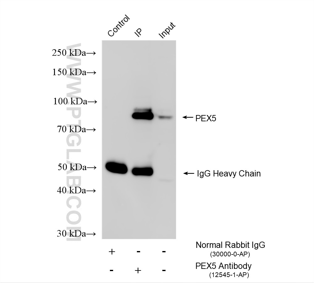 IP result of anti-PEX5 (IP:12545-1-AP, 4ug; Detection:12545-1-AP 1:3000) with Raji cells lysate 1920 ug. Immunoprecipitation (IP) experiment of Raji cells using PEX5 Polyclonal antibody (12545-1-AP)