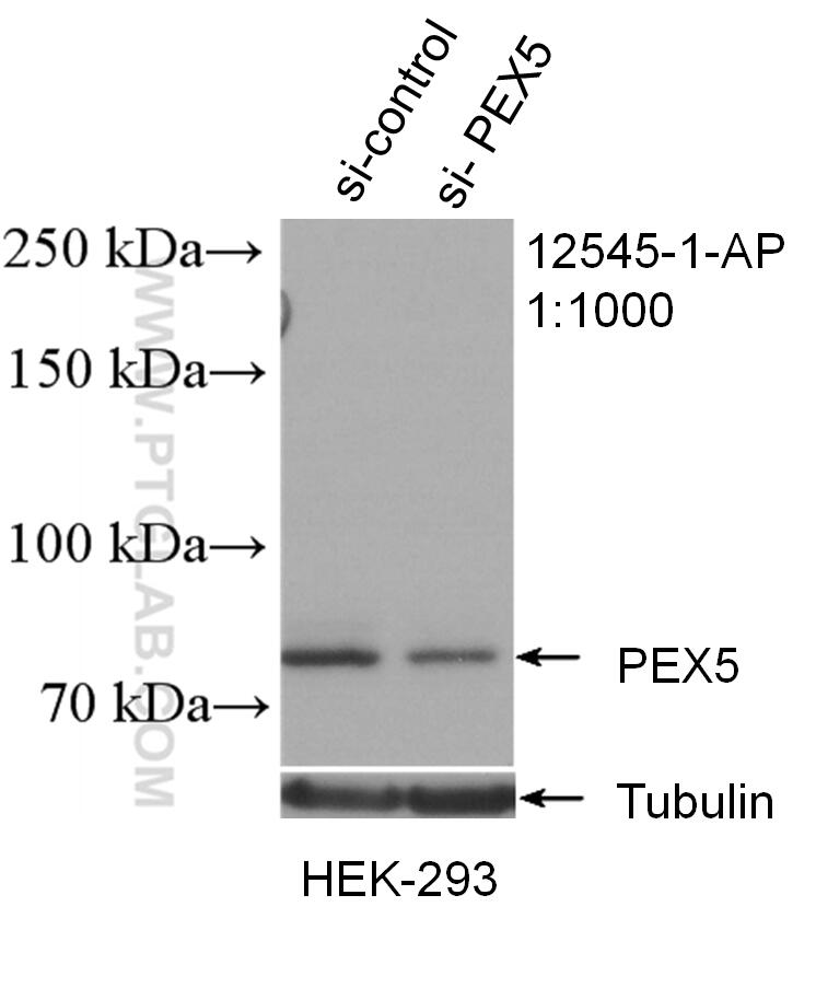 Western Blot (WB) analysis of HEK-293 cells using PEX5 Polyclonal antibody (12545-1-AP)