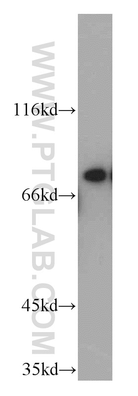 Western Blot (WB) analysis of human brain tissue using PEX5 Polyclonal antibody (12545-1-AP)