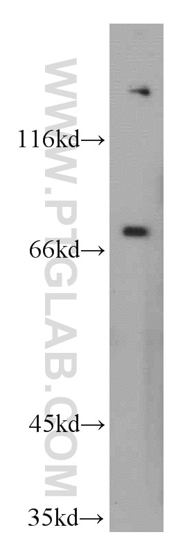 Western Blot (WB) analysis of L02 cells using PEX5 Polyclonal antibody (12545-1-AP)